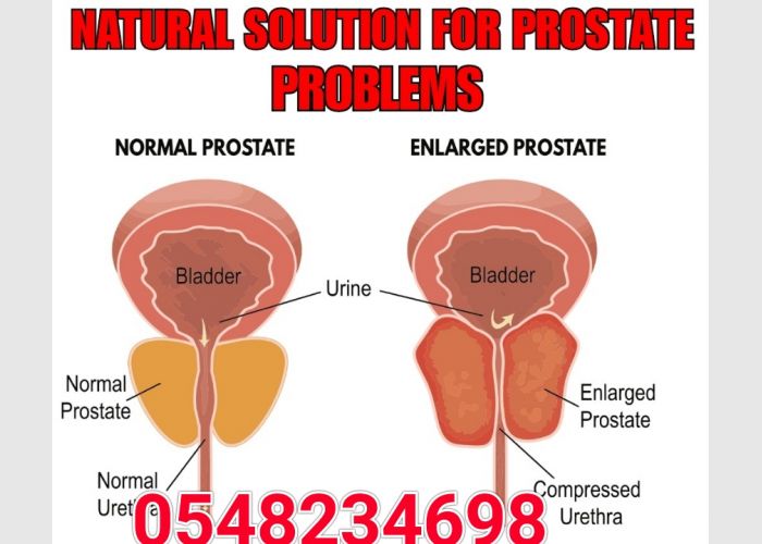 Prostate Health