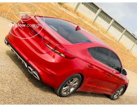 2017 Model Hyundai Elantra SE For Sale