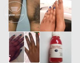 Powerful Knuckles Removal